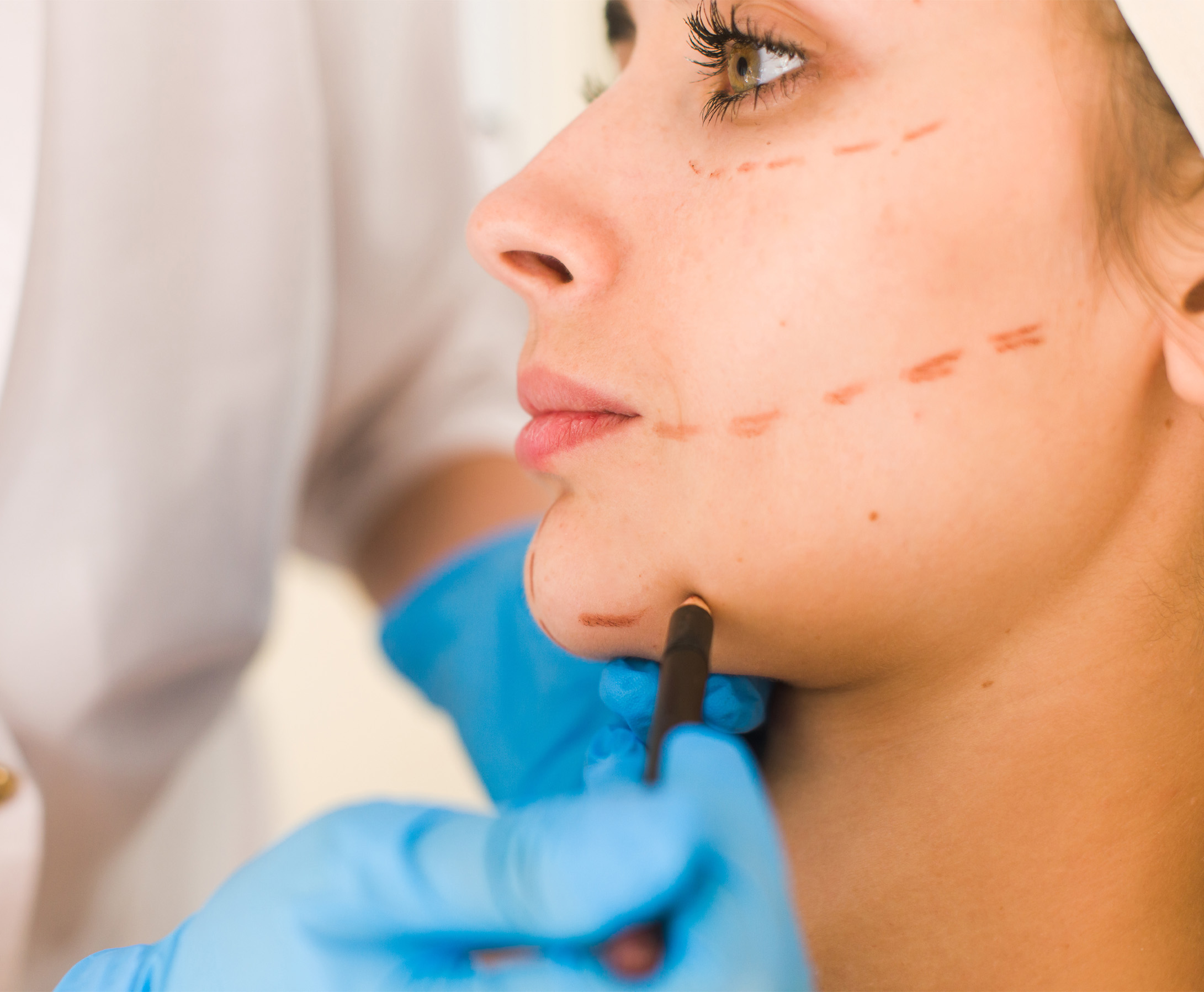 Jawline Sculpting